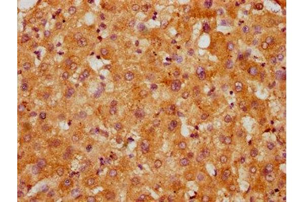CCDC28B antibody  (AA 1-76)