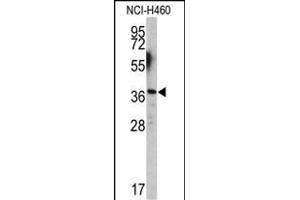Western blot analysis of EN2 antibody (C-term-2) (ABIN391666 and ABIN2841575) in NCI- cell line lysates (35 μg/lane). (EN2 antibody  (C-Term))