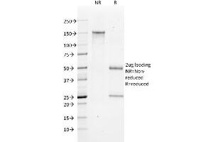 SDS-PAGE Analysis Purified Bax Mouse Monoclonal Antibody (2D2). (BAX antibody  (AA 3-16))