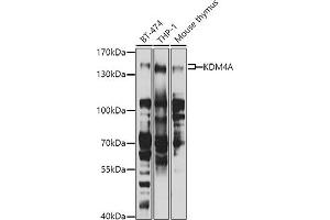 Western blot analysis of extracts of various cell lines, using KDM4A antibody (ABIN6131821, ABIN6142793, ABIN6142795 and ABIN6223960) at 1:1000 dilution. (KDM4A antibody  (AA 585-815))