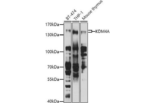 KDM4A 抗体  (AA 585-815)
