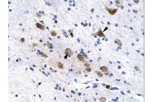 Image no. 1 for anti-Potassium Voltage-Gated Channel, Subfamily H (Eag-Related), Member 6 (KCNH6) (AA 173-222) antibody (ABIN202961) (KCNH6 antibody  (AA 173-222))