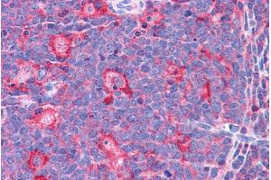 ABIN334516 (3. (TPD52L2 antibody  (C-Term))