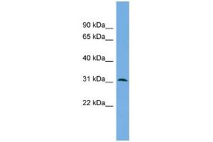 WB Suggested Anti-DAPP1 Antibody Titration: 0. (DAPP1 antibody  (Middle Region))