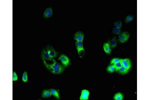 Immunofluorescent analysis of A431 cells using ABIN7144394 at dilution of 1:100 and Alexa Fluor 488-congugated AffiniPure Goat Anti-Rabbit IgG(H+L) (Apelin Receptor antibody  (AA 309-380))
