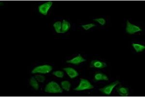 Detection of FN3K in Human Hela Cells using Polyclonal Antibody to Fructosamine-3-Kinase (FN3K) (FN3K antibody  (AA 1-309))
