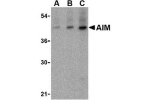 Image no. 1 for anti-CD5 Molecule-Like (CD5L) (N-Term) antibody (ABIN318737) (CD5L antibody  (N-Term))