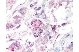 Image no. 3 for anti-Cytochrome P450, Family 19, Subfamily A, Polypeptide 1 (CYP19A1) antibody (ABIN126953) (Aromatase antibody)