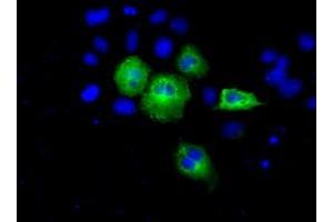Image no. 2 for anti-Acetyl-CoA Acetyltransferase 2 (ACAT2) antibody (ABIN1496403) (ACAT2 antibody)