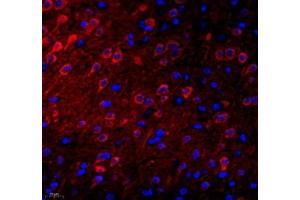 Immunofluorescence of paraffin embedded mouse brain using NECAB1 (ABIN7074753) at dilution of 1: 2300 (400x lens) (NECAB1 antibody)