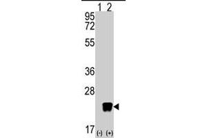 Western blot analysis of ARL3 (arrow) using rabbit ARL3 polyclonal antibody . (ARL3 antibody  (C-Term))