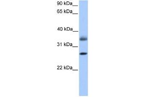 LGALS8 antibody used at 1 ug/ml to detect target protein.
