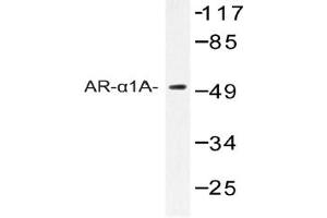 Image no. 1 for anti-Adrenoceptor alpha 1A (ADRA1A) antibody (ABIN272286) (alpha 1 Adrenergic Receptor antibody)