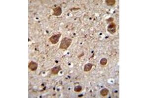 Immunohistochemistry analysis in formalin fixed and paraffin embedded human brain tissue reacted with KCTD8 Antibody (C-term) followed which was peroxidase conjugated to the secondary antibody and followed by DAB staining.