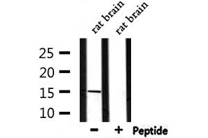 Western blot analysis of extracts from rat brain, using KISS1  Antibody. (KISS1 antibody  (Internal Region))