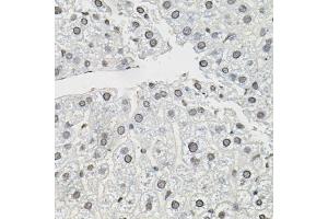 Immunohistochemistry of paraffin-embedded mouse liver using TCEB1 antibody (ABIN6131624, ABIN6148930, ABIN6148932 and ABIN6219151) (40x lens).