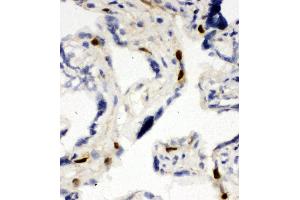 Immunohistochemistry (IHC) image for anti-Minichromosome Maintenance Complex Component 6 (MCM6) (AA 589-605), (Middle Region) antibody (ABIN3044159)