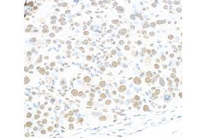 Immunohistochemistry (IHC) image for anti-RNA-binding protein Raly (RALY) (AA 256-306) antibody (ABIN7454547) (Raly antibody  (AA 256-306))