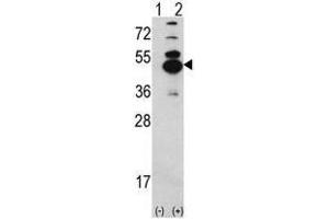 Image no. 1 for anti-Calcium/calmodulin-Dependent Protein Kinase ID (CAMK1D) (N-Term) antibody (ABIN452804) (CAMK1D antibody  (N-Term))