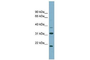 N6AMT1 antibody used at 1 ug/ml to detect target protein.