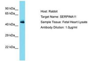 Image no. 1 for anti-serpin Peptidase Inhibitor, Clade A (Alpha-1 Antiproteinase, Antitrypsin), Member 11 (SERPINA11) (AA 203-252) antibody (ABIN6750486)