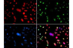 Immunofluorescence analysis of GFP-RNF168 transgenic U2OS cells using RAG2 antibody. (RAG2 antibody  (AA 258-527))