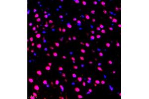 Immunofluorescence of paraffin embedded mouse brain using ZNF498 (ABIN7076253) at dilution of 1:650 (400x lens) (Zinc Finger and SCAN Domain Containing 25 (ZSCAN25) antibody)