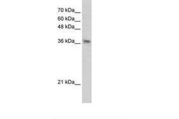 PHYHIP antibody  (AA 51-100)