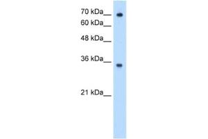 Western Blotting (WB) image for anti-IgG receptor FcRn (FcRn) antibody (ABIN2462979) (FcRn antibody)