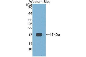 Western Blotting (WB) image for anti-S100 Calcium Binding Protein A3 (S100A3) (AA 1-101) antibody (ABIN3201662) (S100A3 antibody  (AA 1-101))