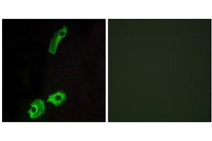 Immunofluorescence analysis of HeLa cells, using GPR151 antibody. (GPR151 antibody  (C-Term))