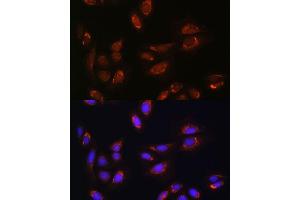 Immunofluorescence analysis of U-2 OS cells using RALGDS antibody (ABIN7269838) at dilution of 1:100. (RALGDS antibody)