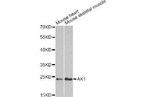 Western blot analysis of extracts of various cell lines, using AK1 antibody. (Adenylate Kinase 1 antibody)