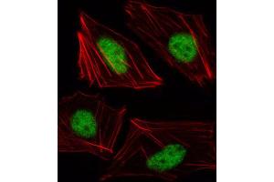 Immunofluorescence (IF) image for anti-T-Box 15 (TBX15) antibody (ABIN3000287) (T-Box 15 antibody)