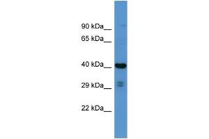 Host: Rabbit Target Name: SCAMP3 Sample Type: RPMI-8226 Whole cell lysates Antibody Dilution: 1. (SCAMP3 antibody  (N-Term))
