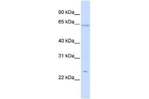 WB Suggested Anti-PRDX2 Antibody Titration:  0. (Peroxiredoxin 2 antibody  (Middle Region))