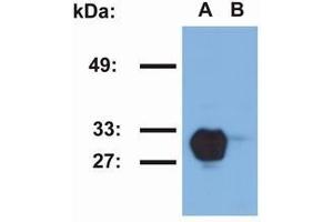 Western Blotting (WB) image for anti-Major Histocompatibility Complex, Class II, DR beta 1 (HLA-DRB1) antibody (ABIN238469) (HLA-DRB1 antibody)