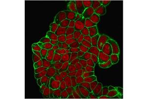 Immunofluorescent staining of PFA-fixed MCF-7 cells. (CD47 antibody)