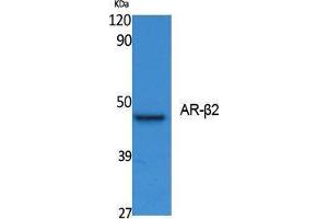 Western Blotting (WB) image for anti-Androgen Receptor beta 2 (Ser127) antibody (ABIN3187616) (Androgen Receptor beta 2 antibody  (Ser127))