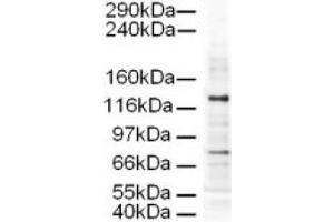 Image no. 1 for anti-Adaptor-Related Protein Complex 3, delta 1 Subunit (AP3D1) (AA 686-698) antibody (ABIN401171) (AP3D1 antibody  (AA 686-698))