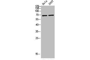 Western Blot analysis of HELA 293T cells using Phospho-PKC ζ (T560) Polyclonal Antibody (PKC zeta antibody  (pThr560))
