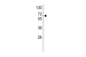 CYP4F3 antibody  (N-Term)