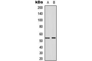 Western blot analysis of Annexin A7 expression in A549 (A), NS-1 (B) whole cell lysates. (Annexin VII antibody  (Center))