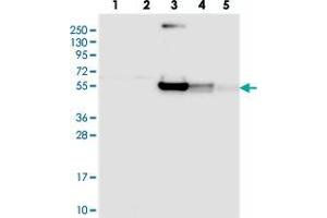 Western blot analysis of Lane 1: RT-4, Lane 2: U-251 MG, Lane 3: Human Plasma, Lane 4: Liver, Lane 5: Tonsil with RINL polyclonal antibody . (RINL antibody)