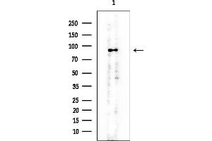 Western blot analysis of lysates from MCF7 cells, using EEF2 Mouse Monoclonal Antibody at 1/1000 dilution.