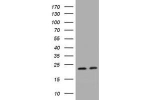 Image no. 1 for anti-GTPase Kras (KRAS) antibody (ABIN1499069) (K-RAS antibody)