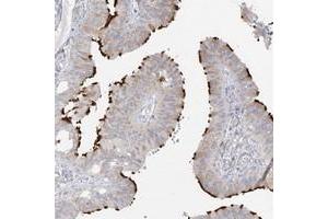 Immunohistochemical staining of human fallopian tube with LBA1 polyclonal antibody  shows distinct positivity in cilia of glandular cells. (LBA1 antibody)