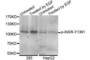 Western blot analysis of extracts of various cell lines, using Phospho-INSR-Y1361 antibody (ABIN5969899). (ISR-beta antibody  (pTyr1361, Tyr1361))