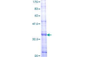 Image no. 1 for Discoidin Domain Receptor tyrosine Kinase 1 (DDR1) (AA 278-377) protein (GST tag) (ABIN1351298) (DDR1 Protein (AA 278-377) (GST tag))