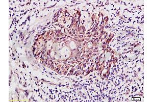 Formalin-fixed and paraffin embedded human skin labeled with Anti-RhoA Polyclonal Antibody (ABIN738846), Unconjugated 1:400 followed by conjugation to the secondary antibody and DAB staining